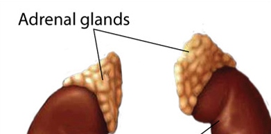 Laparoscopic Adrenalectomy